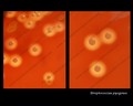 streptococcus pyogenes